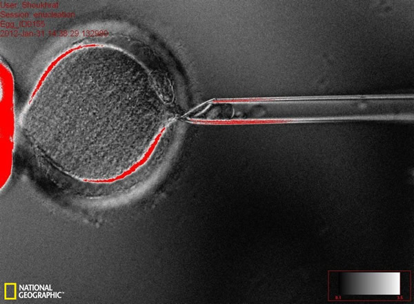 �ɹ���¡������̥����ȡ��ϸ��