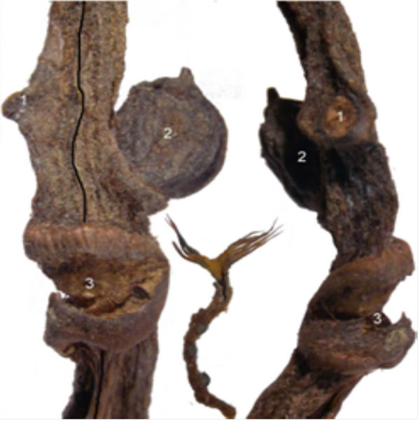 ������еѹ��ȱʧ������£�ԭ���������е����飨���ӣ���Ϊ��������