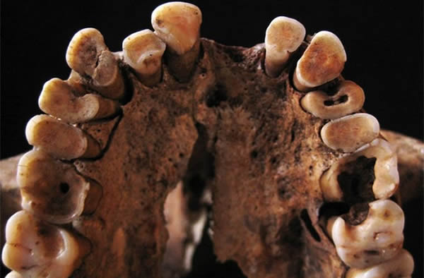The teeth from skeletons unearthed in the Grotte des Pigeons cave in Morocco rev