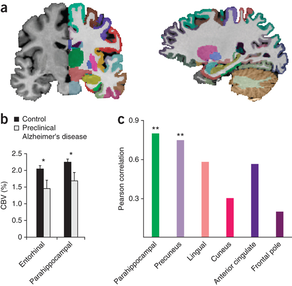 С໼ߴĳһܵմ֢쳣׵Ӱ