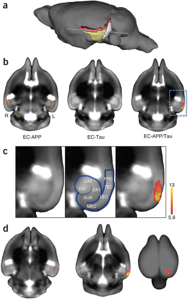 С໼ߴĳһܵմ֢쳣׵Ӱ