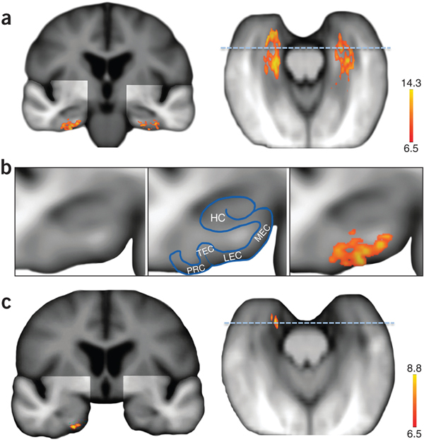 С໼ߴĳһܵմ֢쳣׵Ӱ