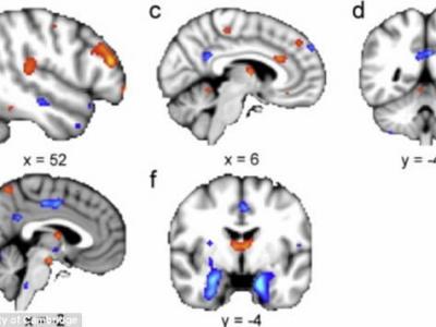 多巴胺神经元的复杂性 - 神秘的地球 科学|自然