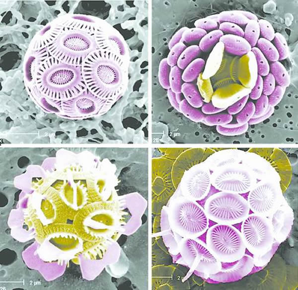四种颗石藻球（钙质超微浮游植物的一类）的扫描电镜照片