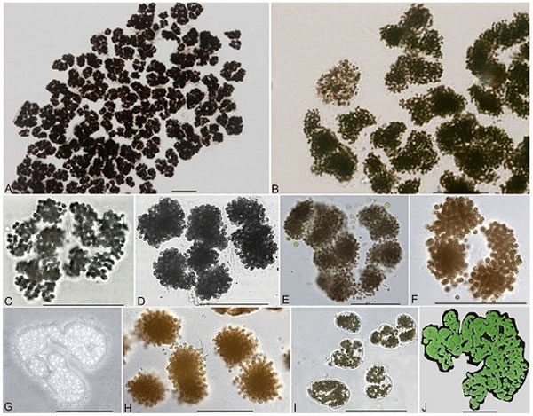 图3  现代微囊藻的群体，呈树枝状等各种不规则形态