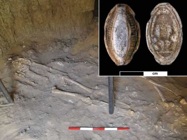 苏丹坟墓中出土的3200年前人类遗骸发现世界最古老癌症