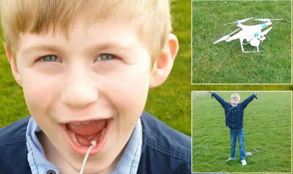 爱尔兰科技迷用无人机替儿子拔牙