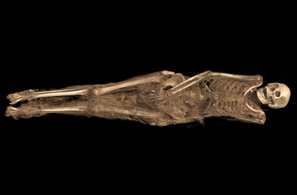 A CT scan shows a 3-D visualization of the mummified remains of a Sudanese woman
