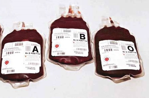 �ձ�����ҽѧ��ѧ�о�Ա���֣�O��Ѫ���߰�֢�����Ļ��ᣬ��A��Ѫ���ߵ�35%��