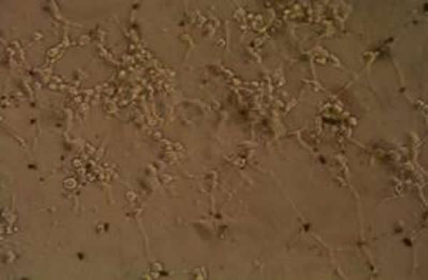 ӫ�⵹����΢���£�������̼���׹����������Ӹ������յ�PC12 ϸ���ֻ����ԣ�ͻ�����ܼ�����֯����״���������ǿ��ϸ���ܶȴ󣨡�200��