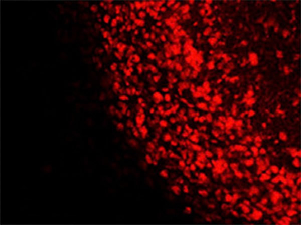 新干细胞匹配成人基因
