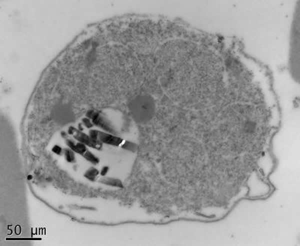 恶性疟原虫裂殖体感染的红细胞