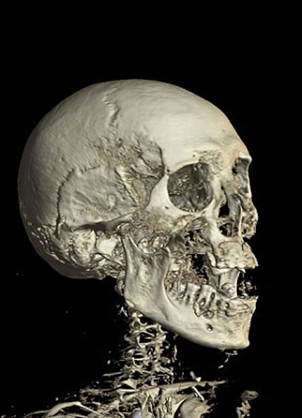 早在19世纪20年代,这个木乃伊是英国驻埃及总领事索尔特埃及考古藏品的其中之一。