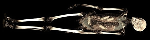 在大英博物馆举办的题为“古代生活,全新发现”的展览中,共有8个木乃伊被打开,这个被误以为舞女的木乃伊是其中之一。