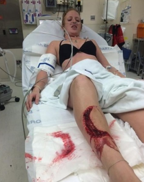 坚强的沃恩遇袭后被送往医院救治