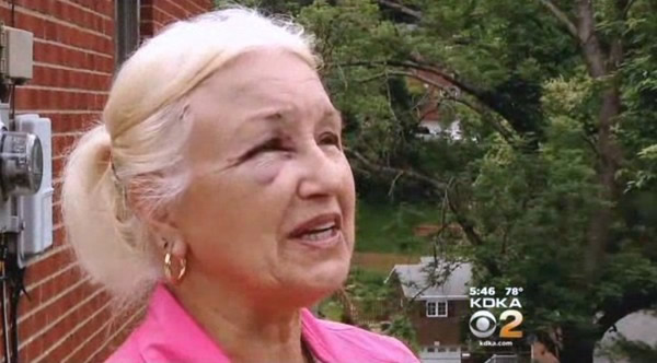 艾琳右眼有明显瘀青