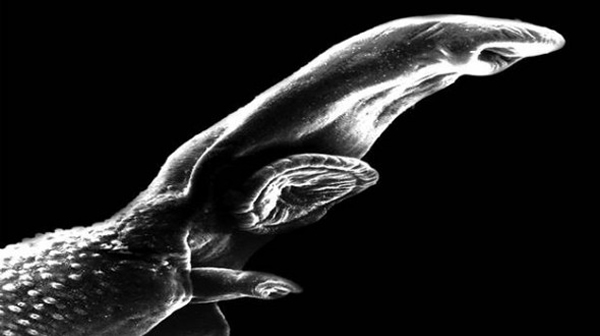 考古学家在叙利亚北部距今6200多年古人类遗骸中发现血吸虫卵