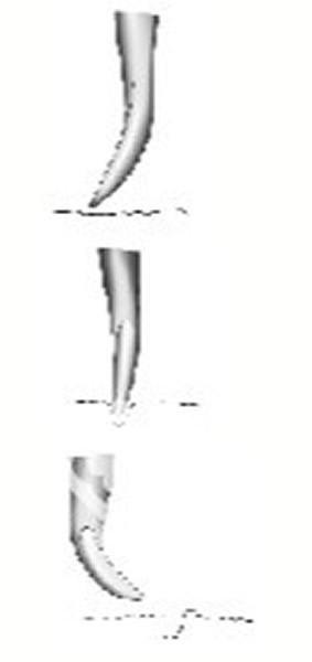 �����������Ӿʱ��ǰ֫�����������˶�������ˮ�����ºۼ���