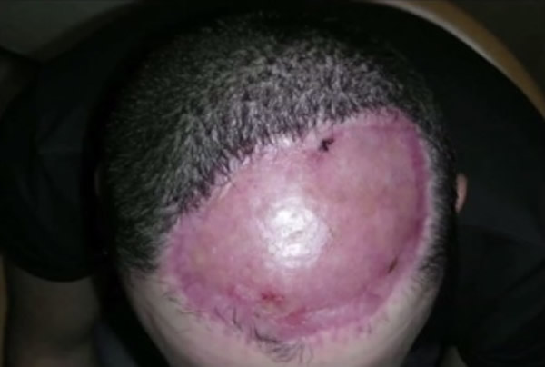 Ӣ��30������͸��ո�¡������Ʒ����ɹ�����