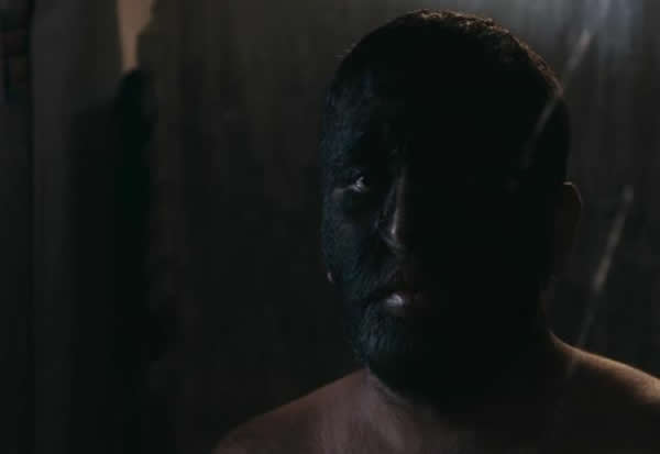 墨西哥男子因患有先天性多毛症被唤作“狼人”