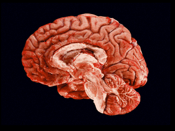 大脑的诸多区块都是靠白质相互连结，而称作白质的神经纤维全长约16万公里，足以绕地球四周。摄于马蒂诺研究中心的这张影像和其他影像，首度揭露了构成认知功能的特定神经