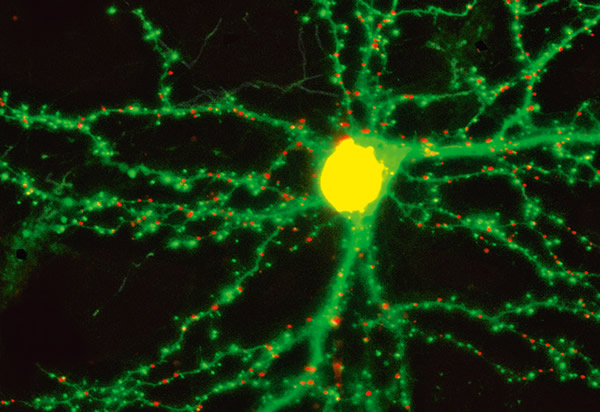 形成记忆时，「大脑会产生实质改变，」南加州大学的唐．亚诺说。从图中这一个老鼠神经元延伸而出的分支上遍布红色和绿色的圆点，代表与其他神经元交换讯息的位置。当老鼠形