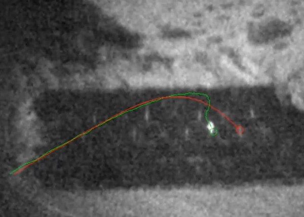 ӵԭĵƫĿ()ϵͳԶ()