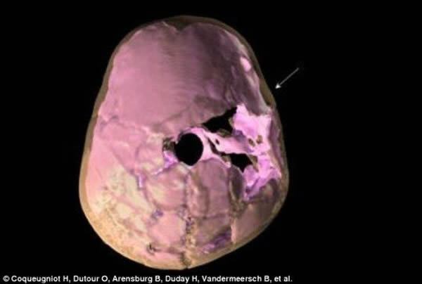 ������ѧ��ͨ��3D�ؽ�������ԭ10����ǰ������ͷ��