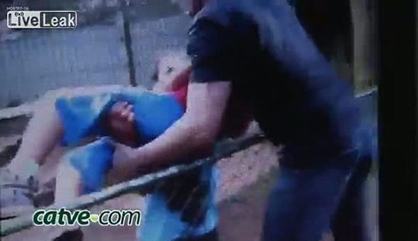 巴西男孩动物园喂老虎被咬掉一只手