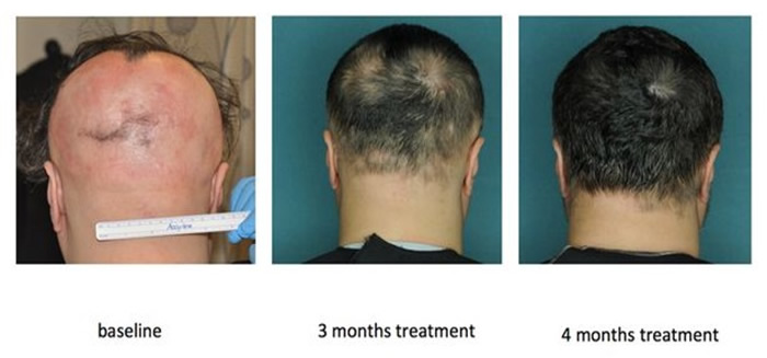 ���в����������º������Ũ��ͷ��