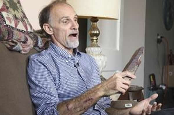 ���б�ķ����մѪʯͷ����������ʯͷ������ܣ��û�������