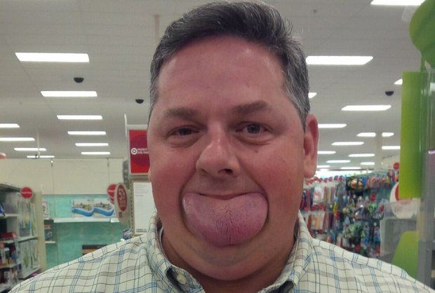 美国一男子舌头宽8.3厘米破吉尼斯世界纪录