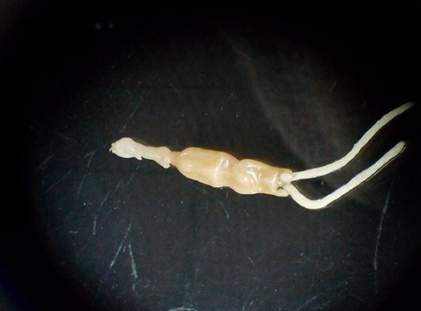 ��ѧ���·��ֵġ�ä�������项�������棩������Լ25mm�� ��ͼƬ�����Ԫ�ṩ