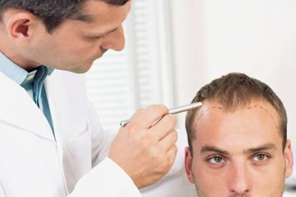 男性如在45岁前出现秃头 晚年患前列腺癌机率