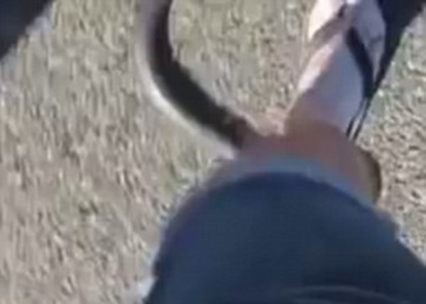 ����ͻȻҧ���޲��ĵ��ҽ��ף�����ʼ�ϲ�����