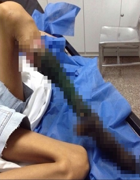 ί������13��Ůͯ�ⶾ��ҧ С�ȸ��ñ��