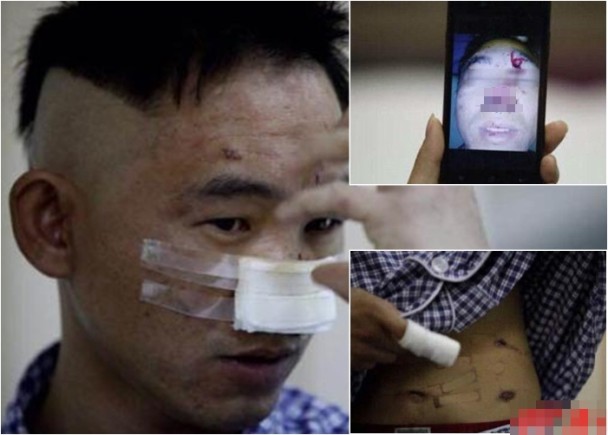 �������Ӳ�ҩ�����Ϯ�� װ������