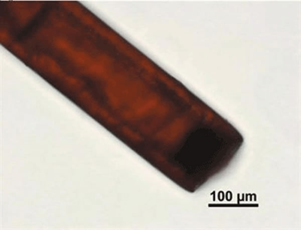 �ﾵ20���¹۲쵽����ũ�ܲ�������ë����