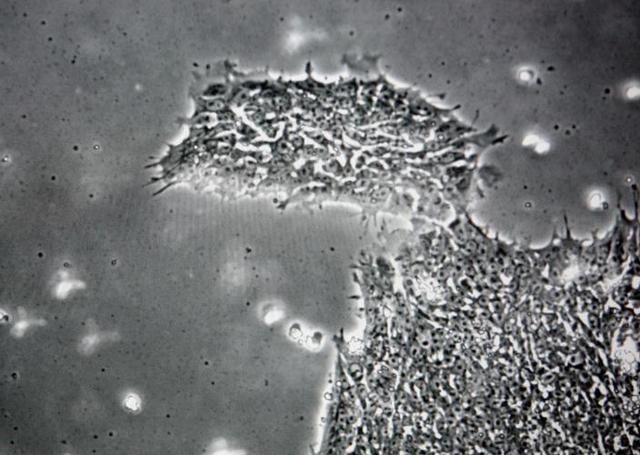 �о���Ա����һ���ܹ�����������֪���˵����ಡ��