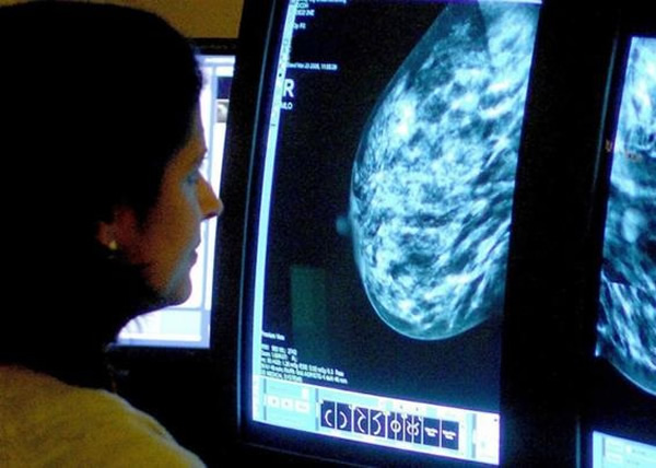 专家指以人工停经方式,可降低癌细胞复发机率。