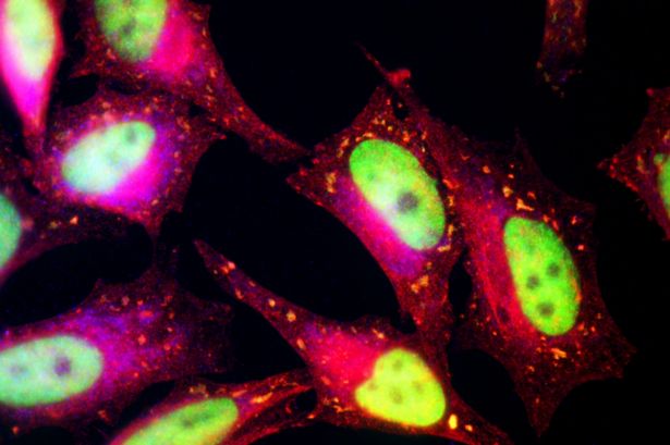 ʷ��˹�ཨ�鲻Ӧ�ٻ�����ʮ�ڼƵĽ�Ǯ��ȥ�о����ư�ϸ��(ͼ)�ķ�����