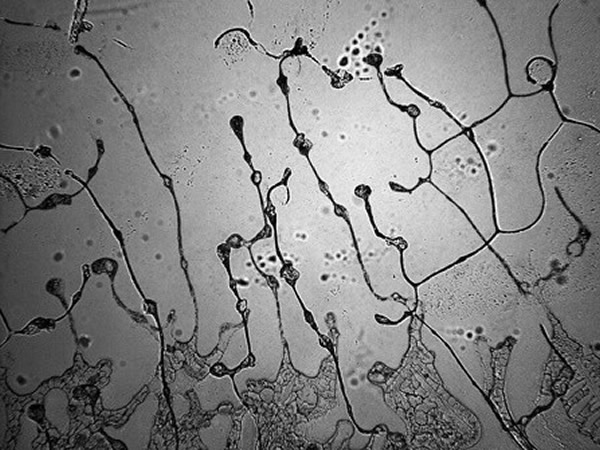 ��ͬ����������������������΢�������Ų�ͬ����̬��