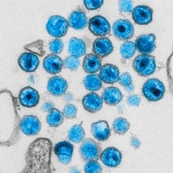 科学界一直认为内源性逆转录病毒的基因,只是人类进化的副产品。