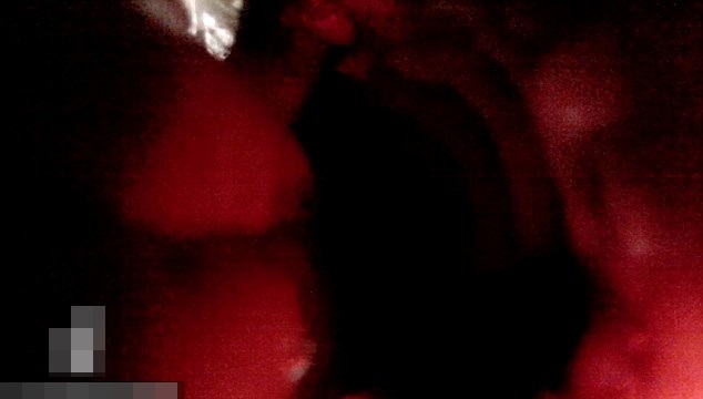 喉咙亦清晰可见