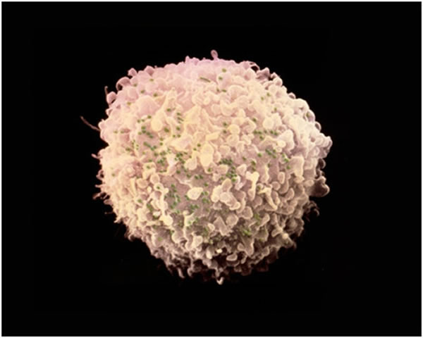 �����Ʒ��״ν���HIV ��ɴ١����������������̲�