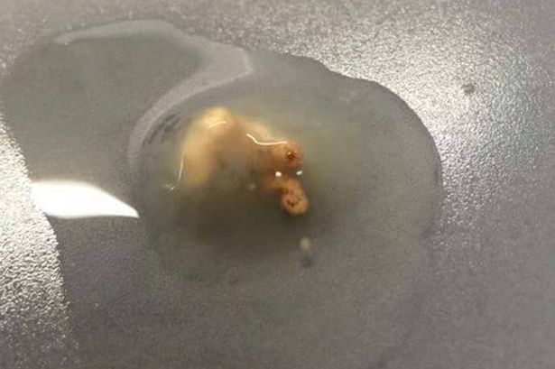 Ӣ��Ů�ӳ�����ʱ����ƽ�׹��ڳ��ֳ��Ѿ����ε�С����̥