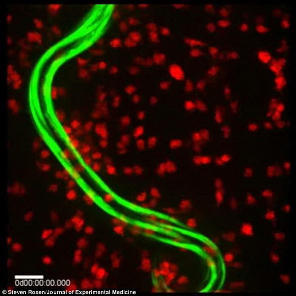 图中嗜曙红细胞是红色部分,秀丽隐杆线虫幼虫是绿色部分,这张照片非常形象真实地显示老鼠体内白血球细胞如何攻击寄生虫。在大约54分钟时,秀丽隐杆线虫开始从一大群嗜曙