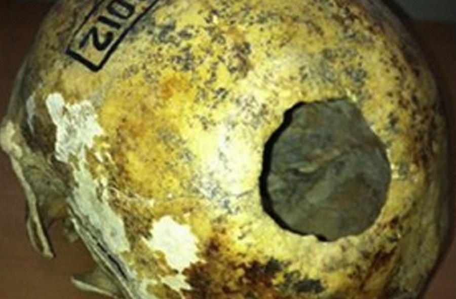 西伯利亚是一个复杂的医学手术中心