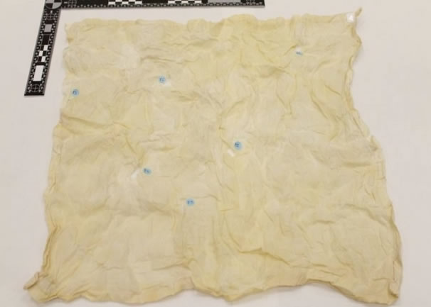 法证专家利用手帕重塑迪安农齐奥的DNA。