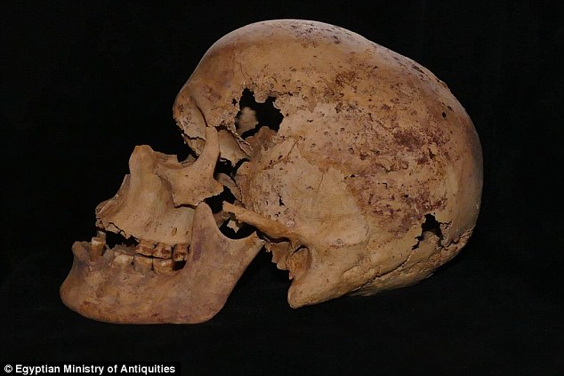 埃及4200年历史成年女性骨骸发现最古老的乳腺癌证据